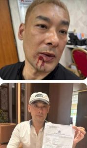 Kasus Pengusaha Keroyok WNA Tiongkok, Polisi Periksa 7 Saksi